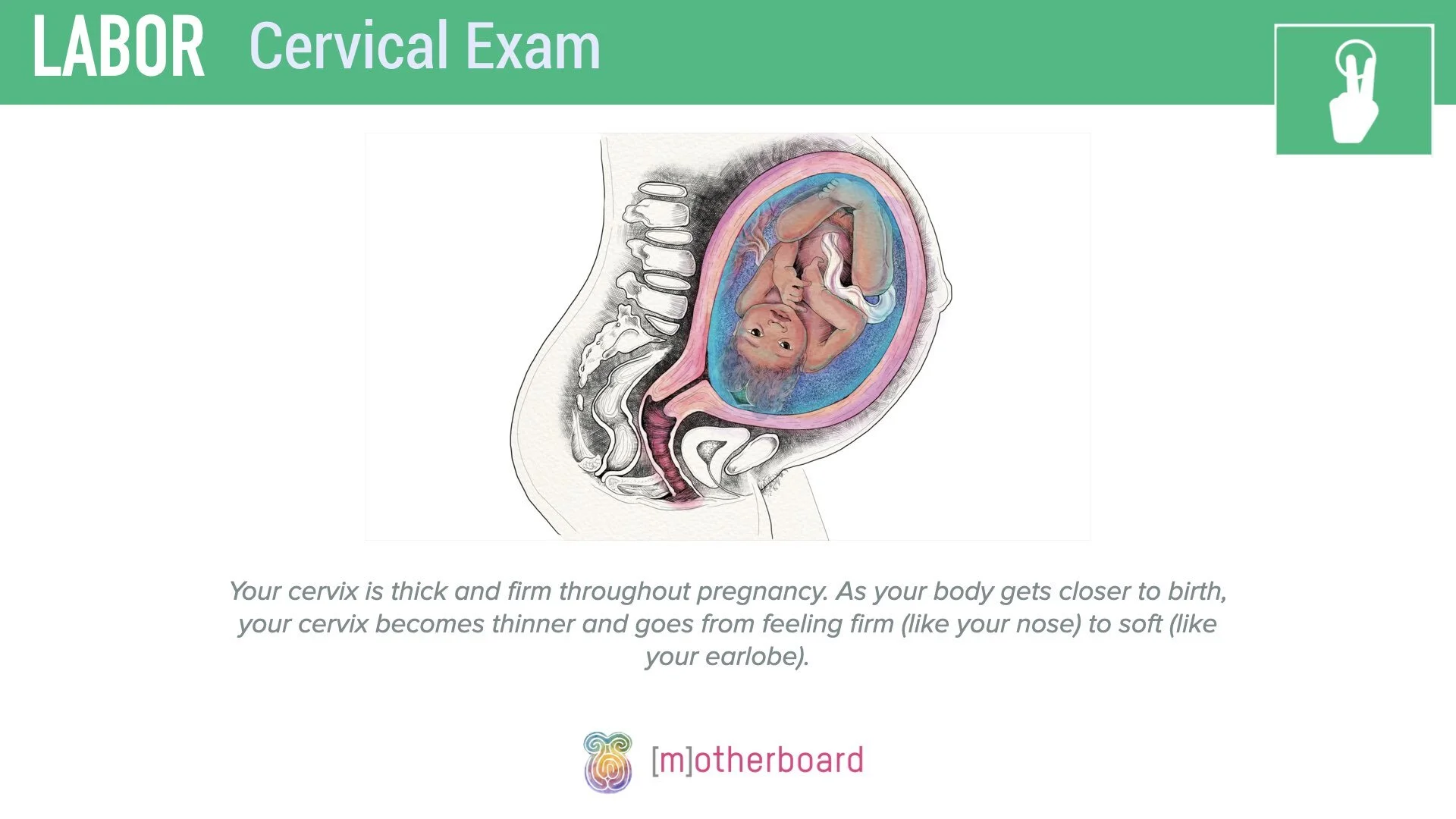 Labor - Cervical Exam.004.jpeg
