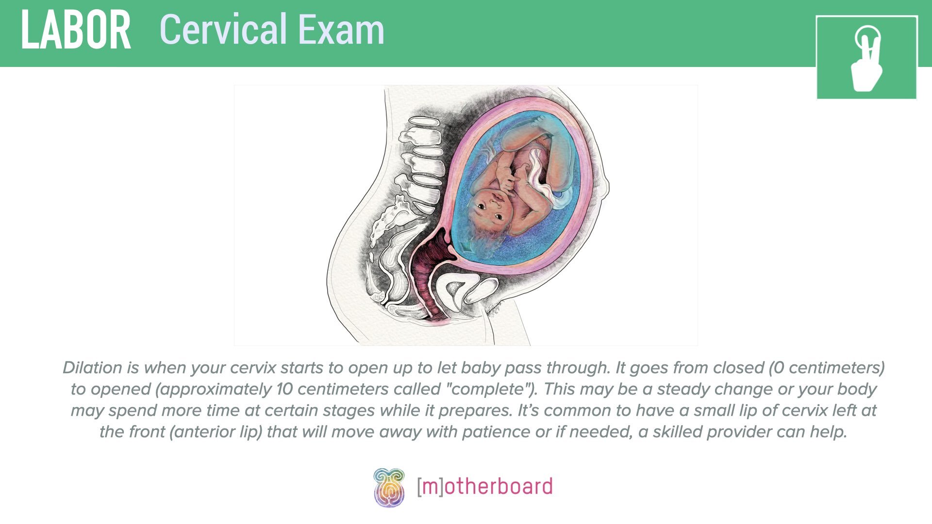 Labor - Cervical Exam.005.jpeg