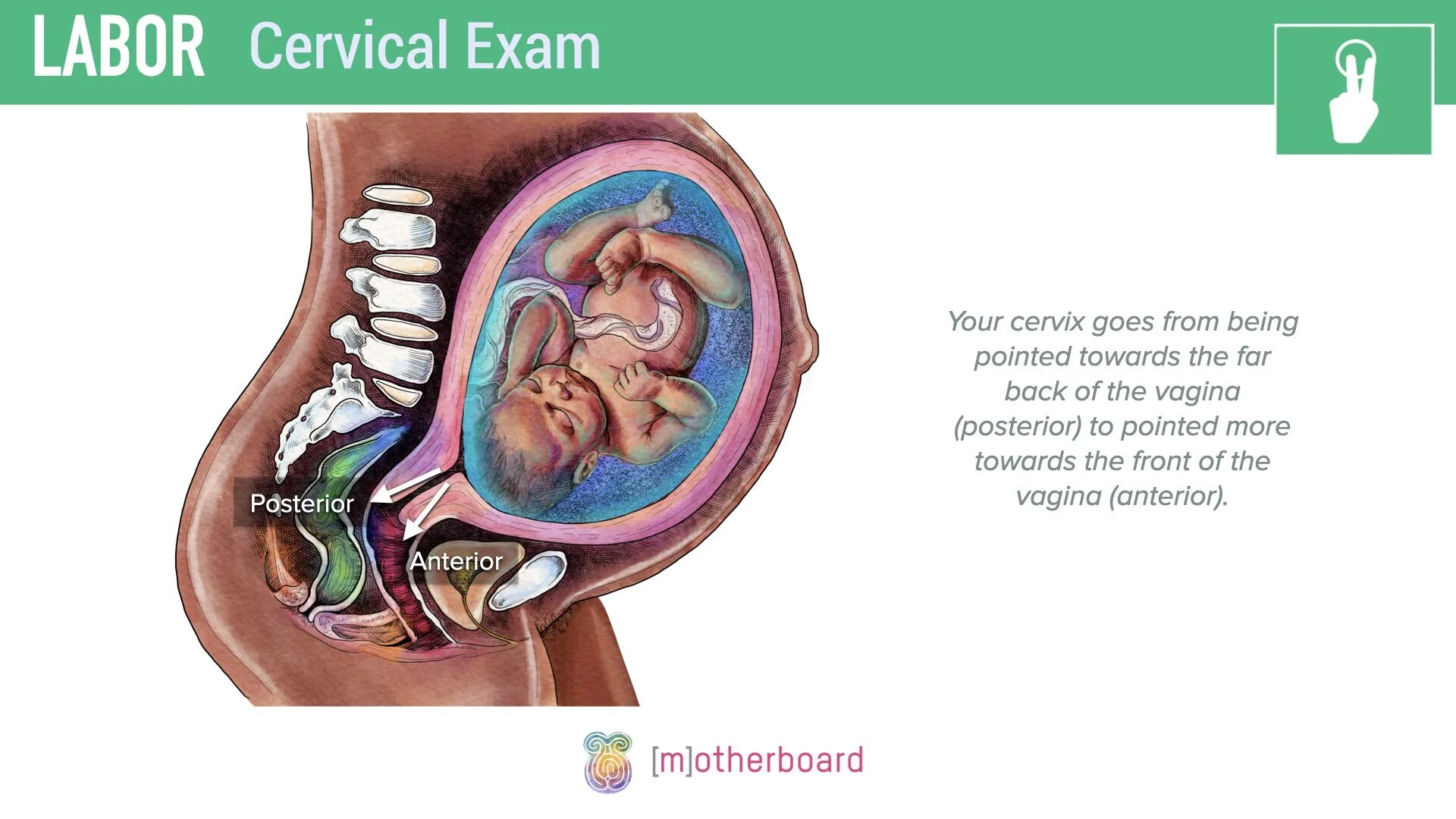 Labor - Cervical Exam.008.jpeg
