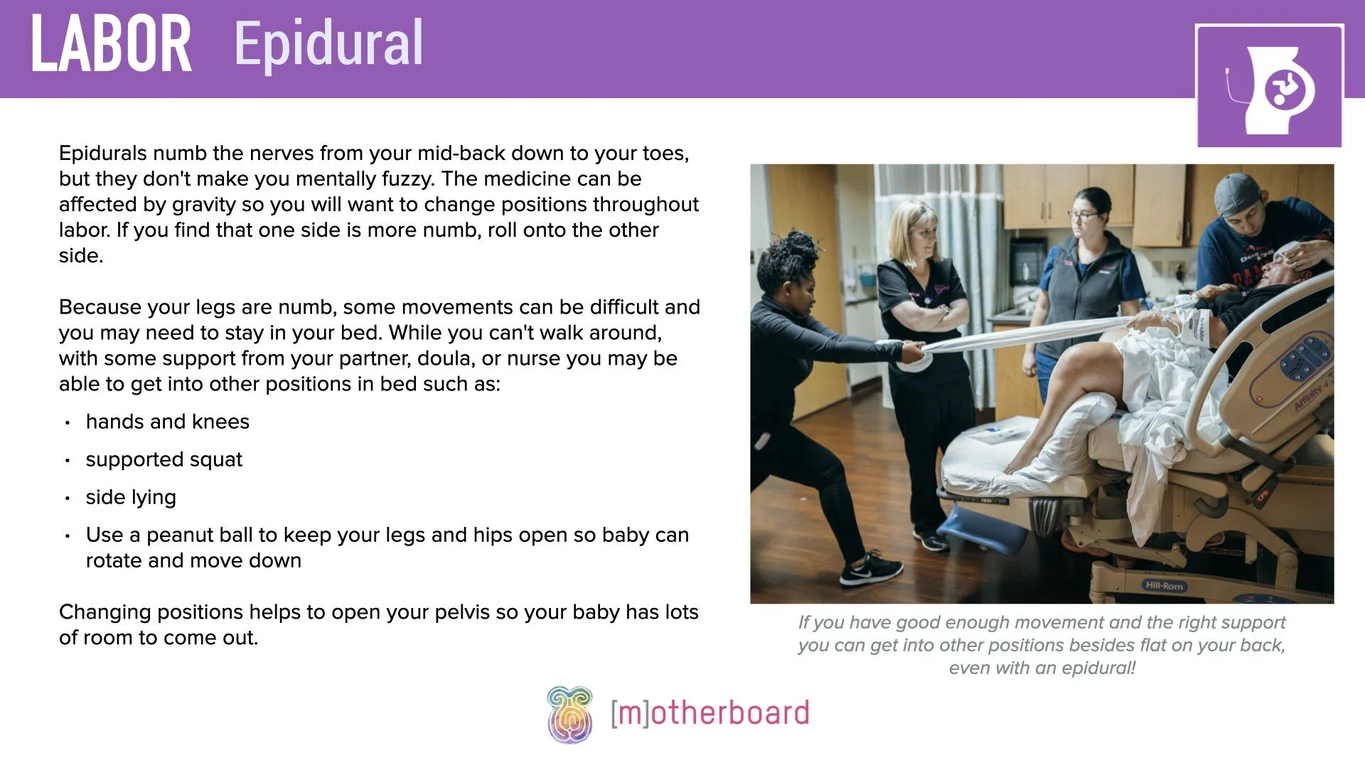 Labor - Pain Management - Epidural.003.jpeg