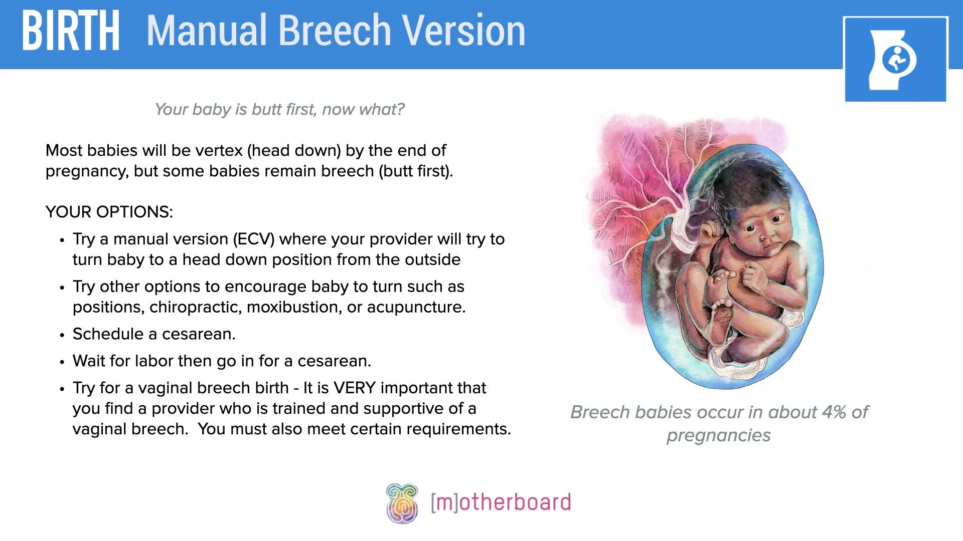 Birth - Breech Overview.002.jpeg