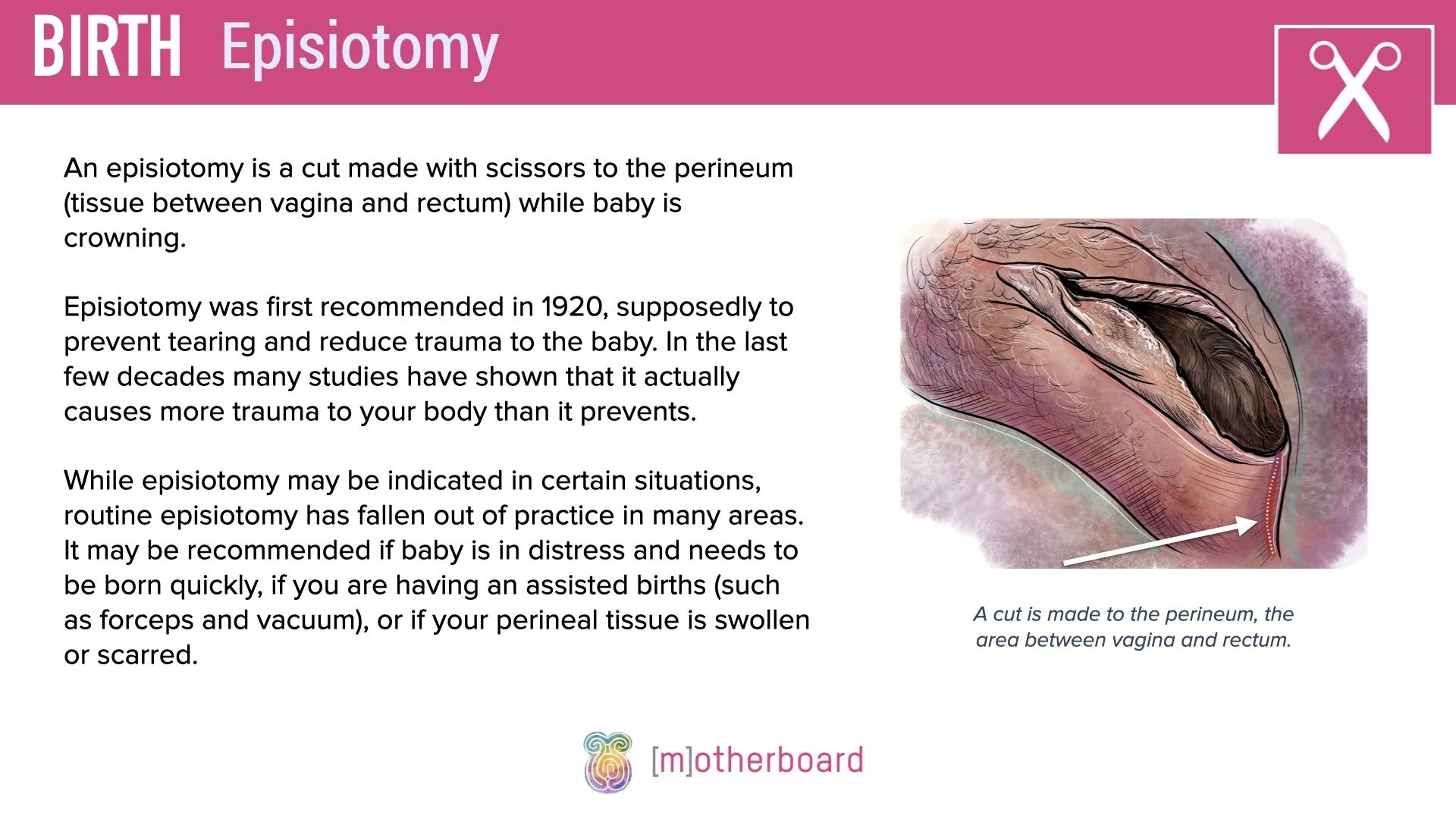 Birth - Assisted Birth Overview.002.jpeg