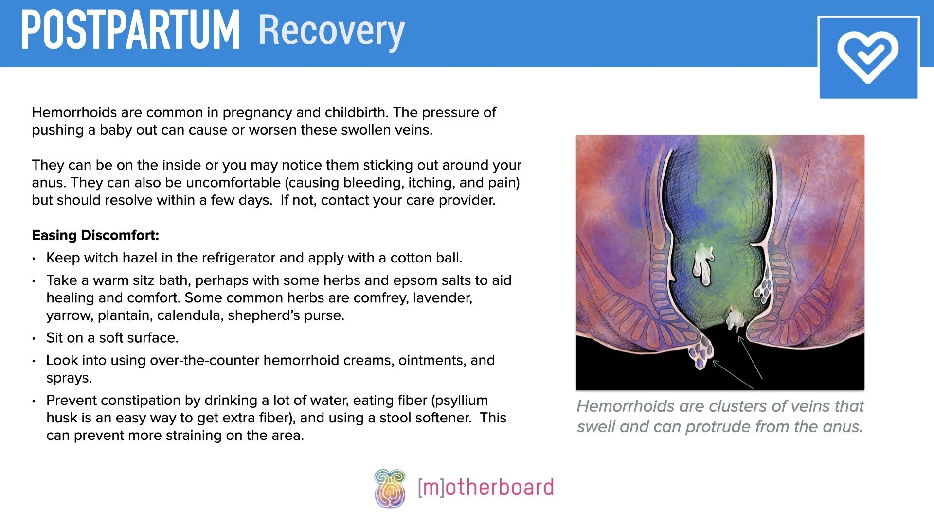 Postpartum - Vaginal Recovery.005.jpeg