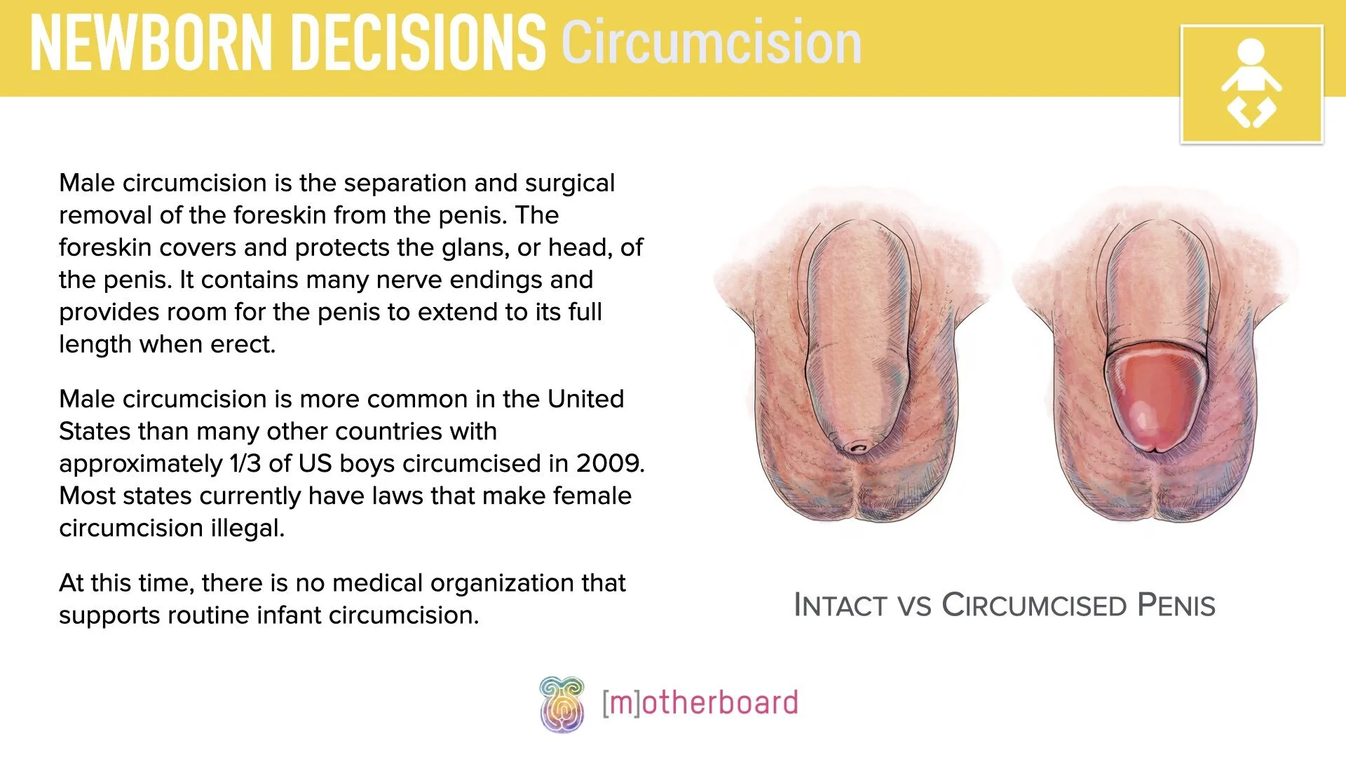 Postpartum - Newborn Decisions - Circumcisions.001.jpeg