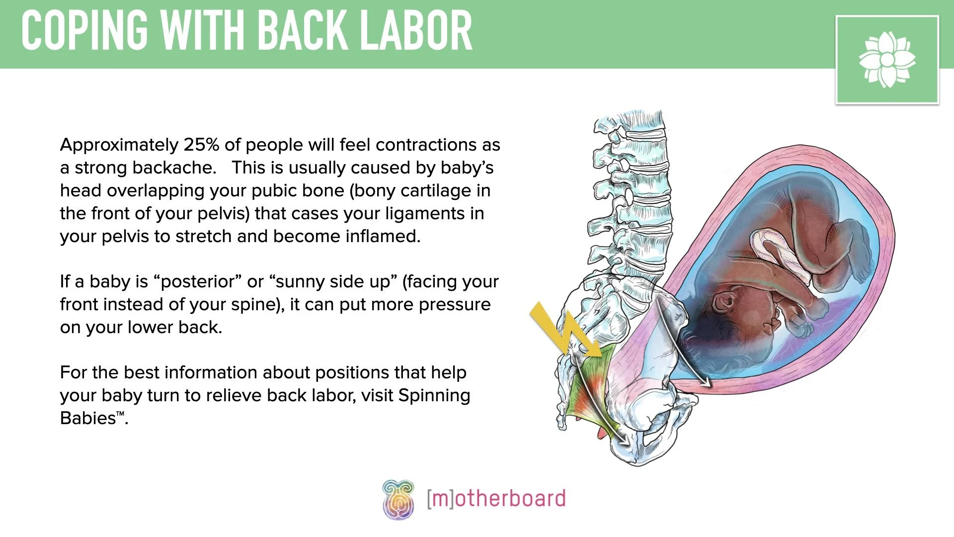 Labor - Back Labor.002.jpeg