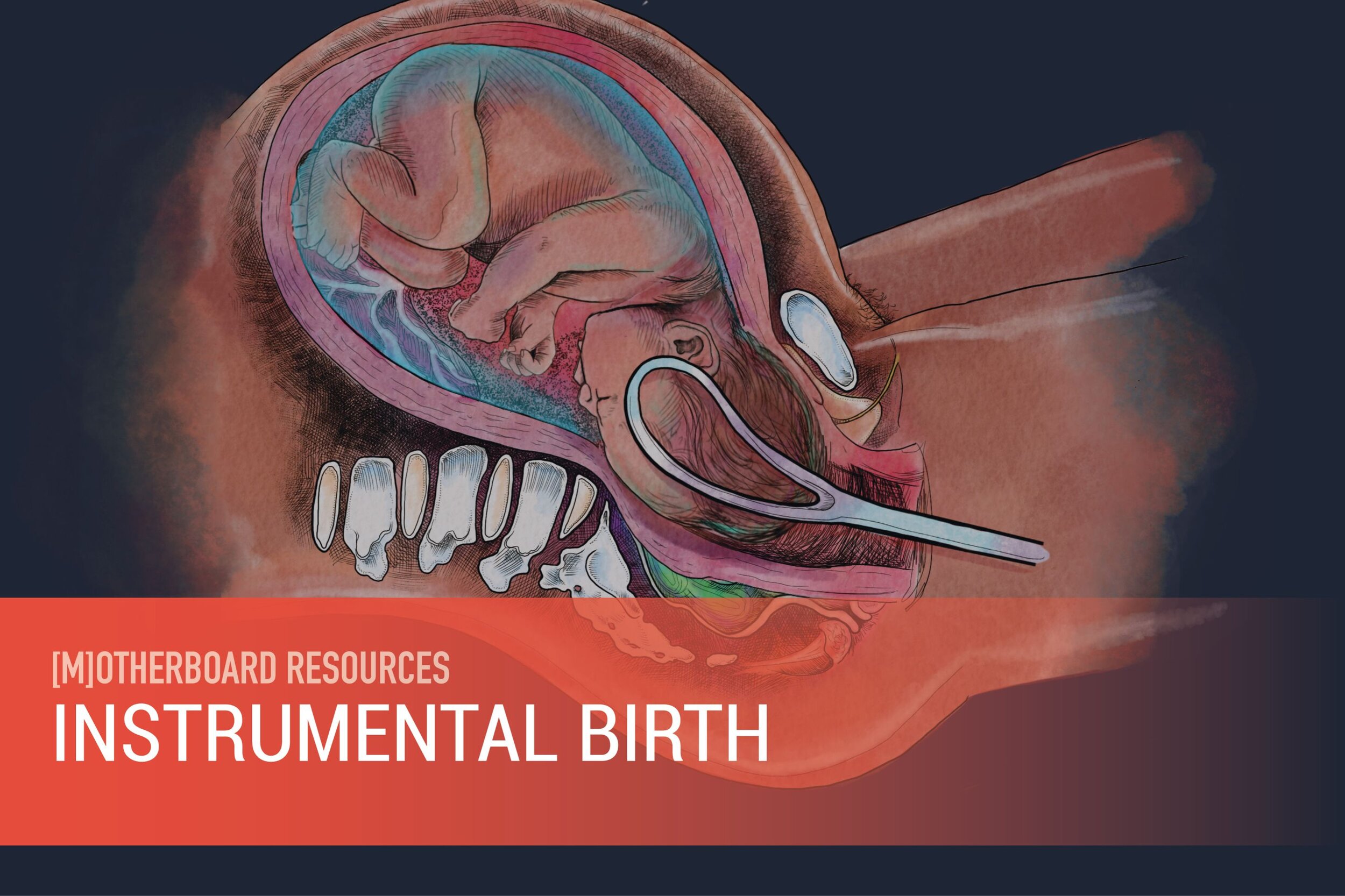 Instrumental Birth.jpg