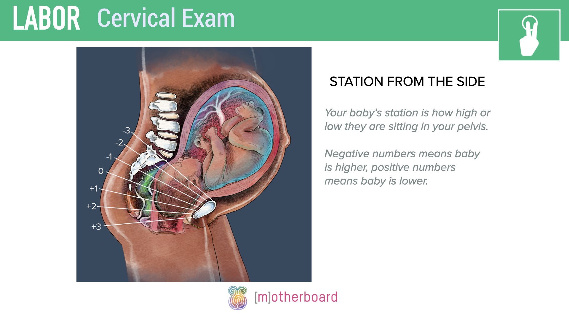 Labor - Cervical Exam.007.jpeg