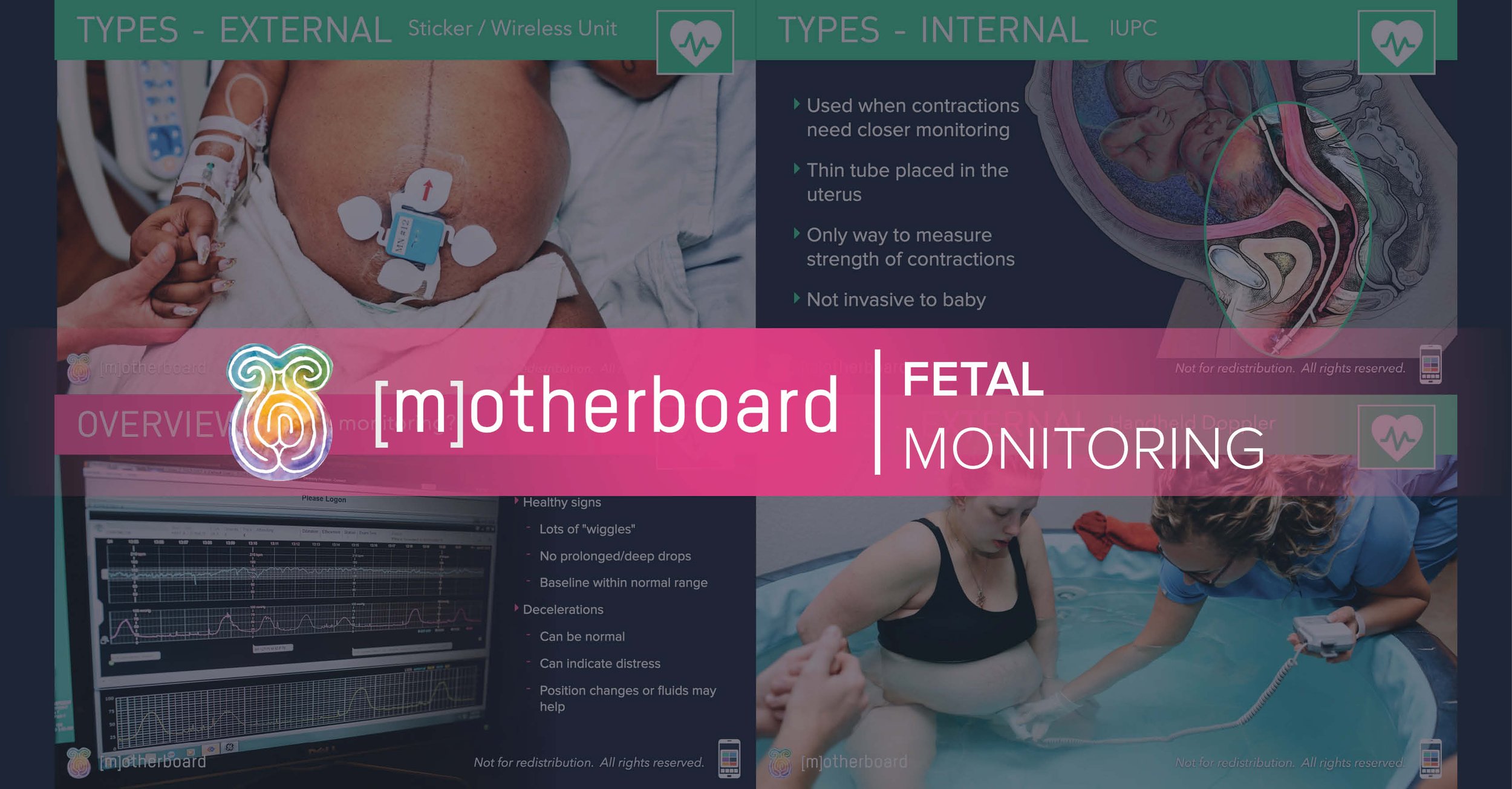 Fetal Monitoring Teaser3.jpg