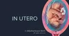The Ultimate Guide: Understanding Artificial Rupture of Membranes (AROM ...