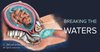 The Ultimate Guide: Understanding Artificial Rupture of Membranes (AROM ...