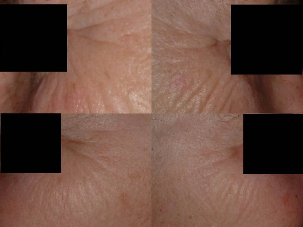 FractionalWrinkles2.jpg