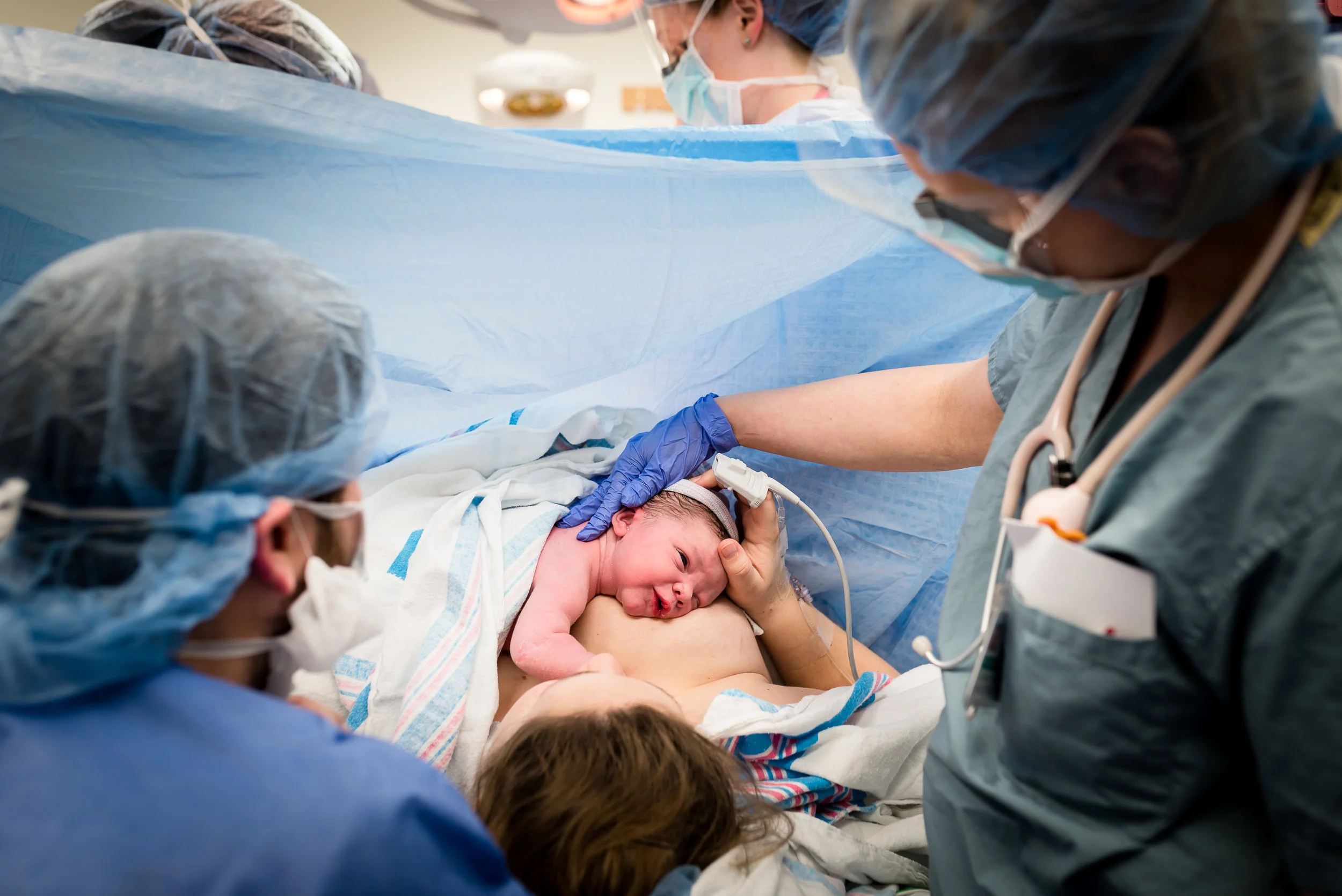 skin to skin in the Operating room after cesarean