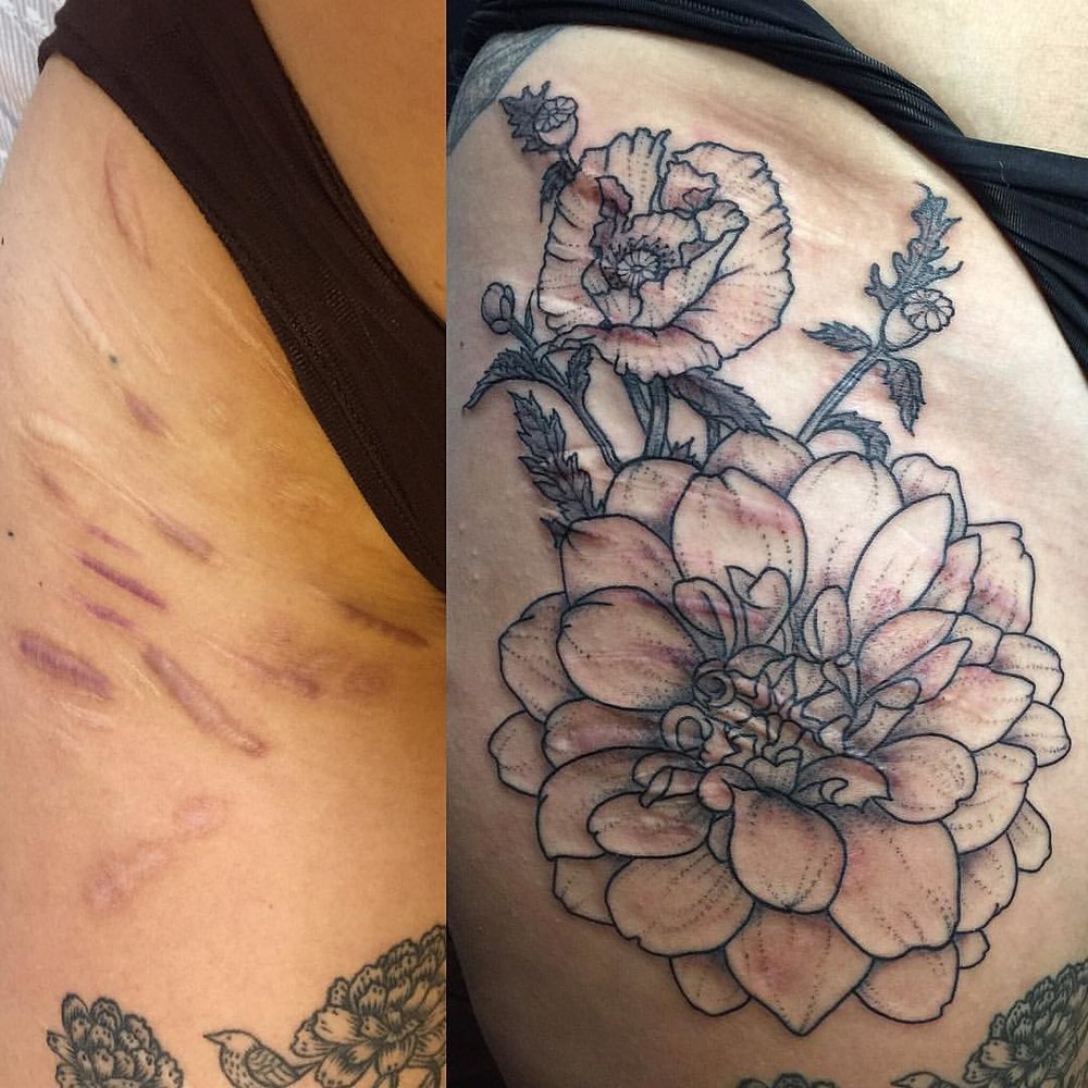 Scar Cover Ups Ink By Push