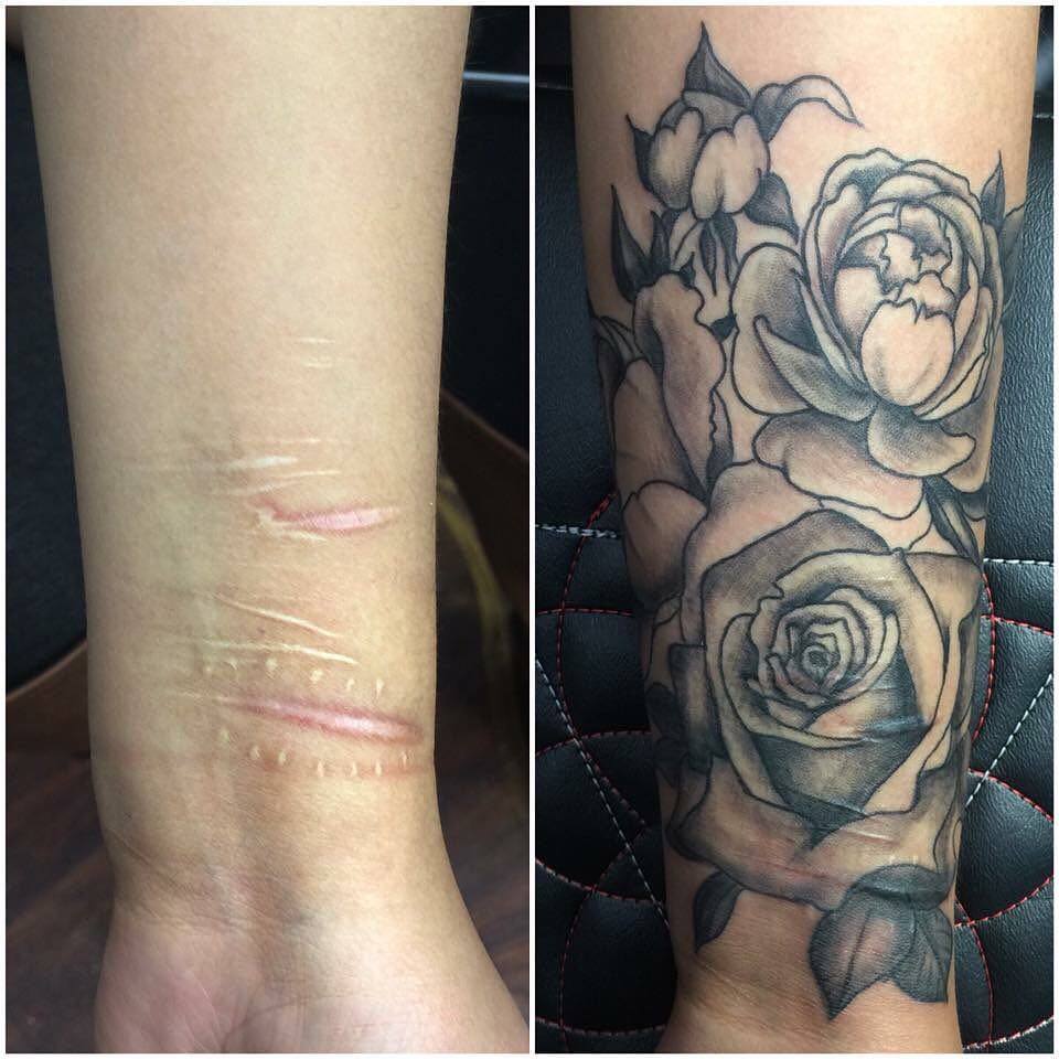 Scar Cover Up Tattoos  Yorkshire Mastectomy Clinic