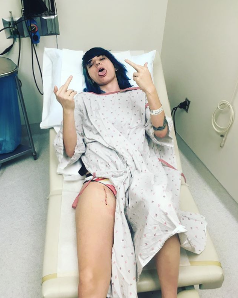 photo Lukas took my first follow up appointment after surgery, first time I saw the cut