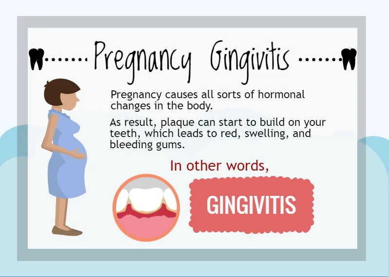 Ask the Dentist Why do my gums bleed? Capstone Dental