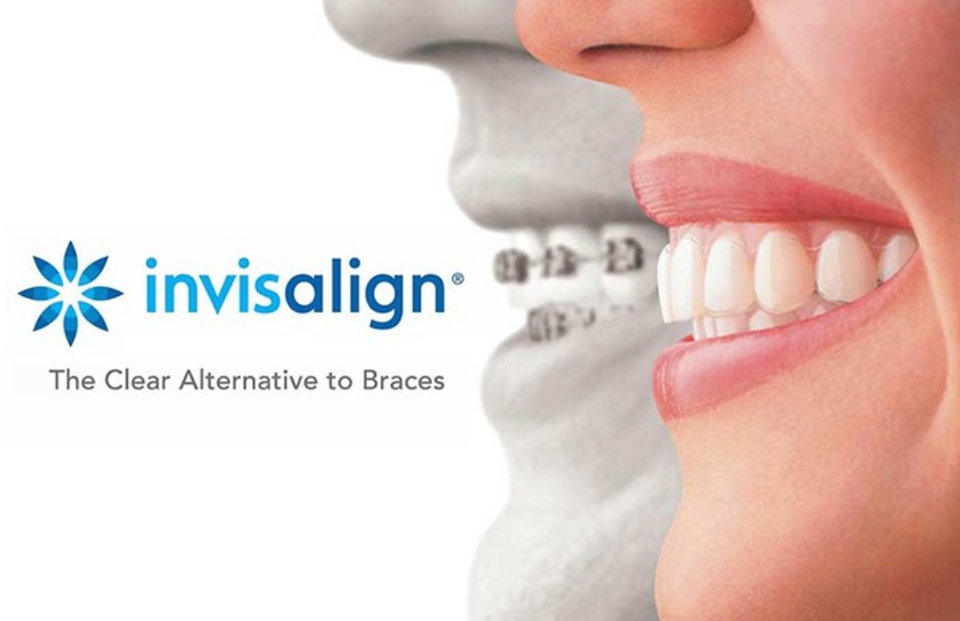 Invisalign Orthodontic Treatment - Clear Braces