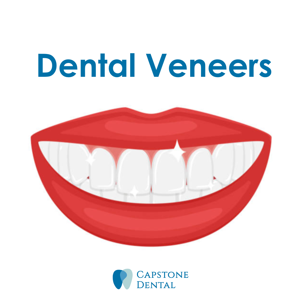 Transform Your Smile with Dental Porcelain Veneers: Your Path to a Perfect Smile