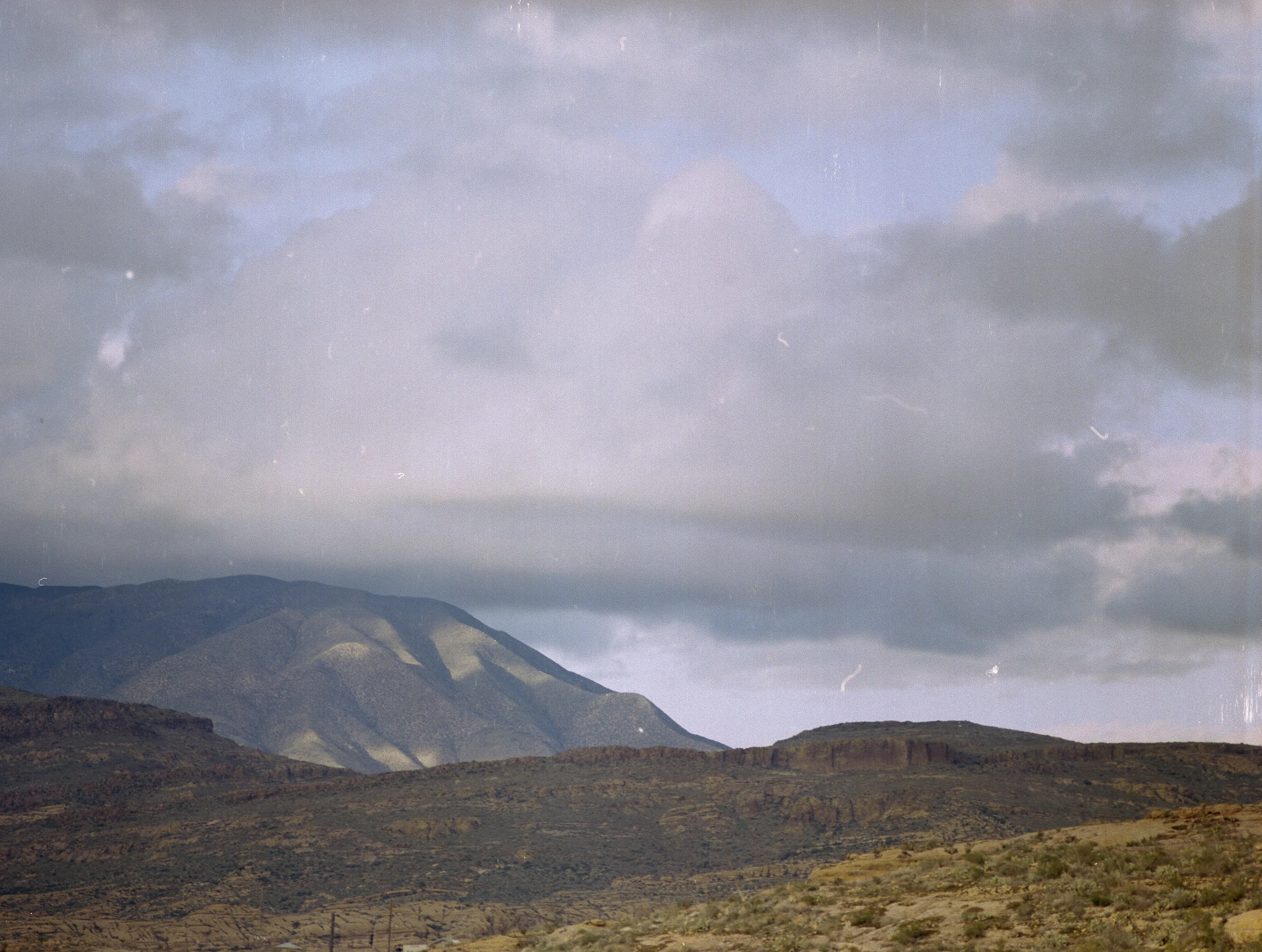 Unedited scan from an unnamed lab in Arizona. Notice the vertical lines across the entire image.