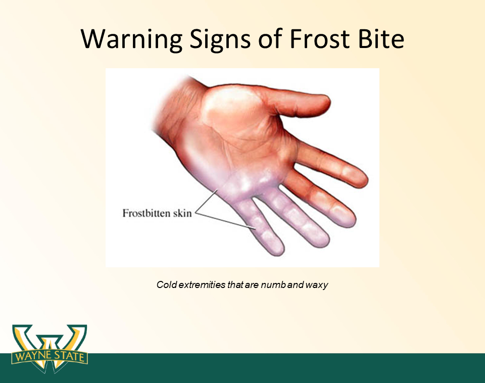 Slide36.PNG