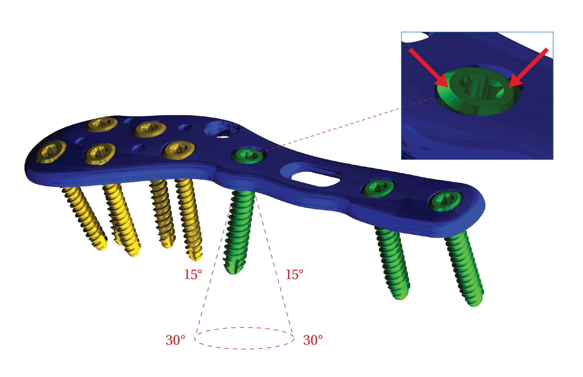 variable-angle2.png