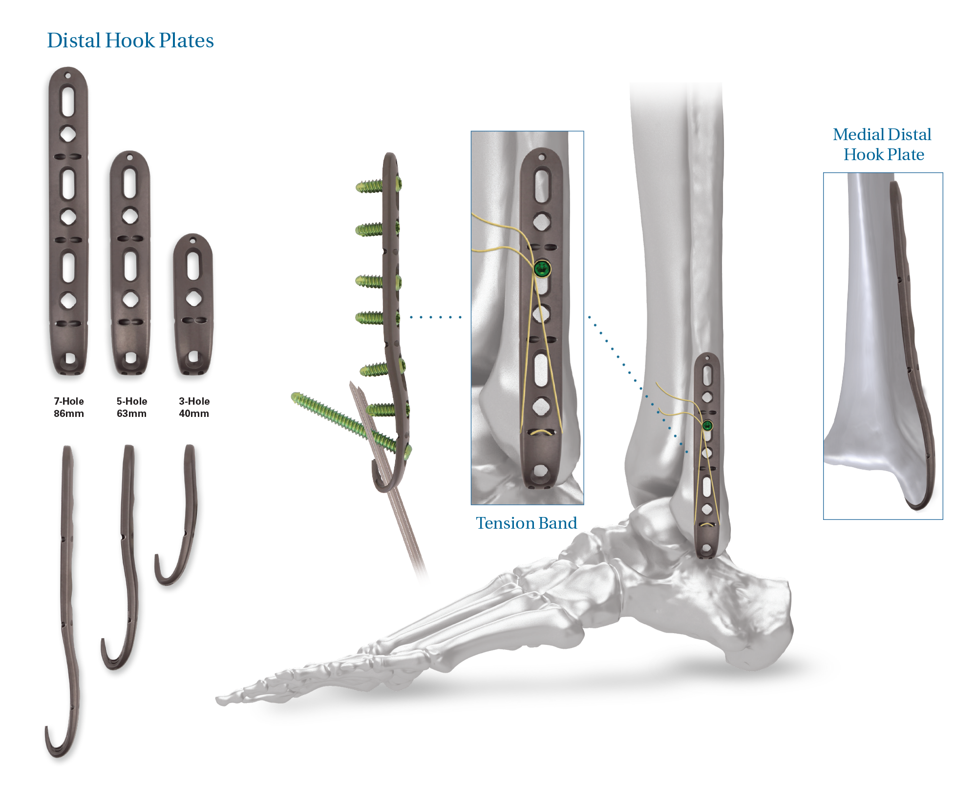 fib-universal-distal-hook.png