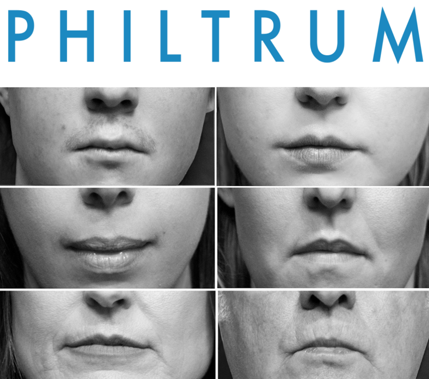 PhiltrumPoster_Banner.png