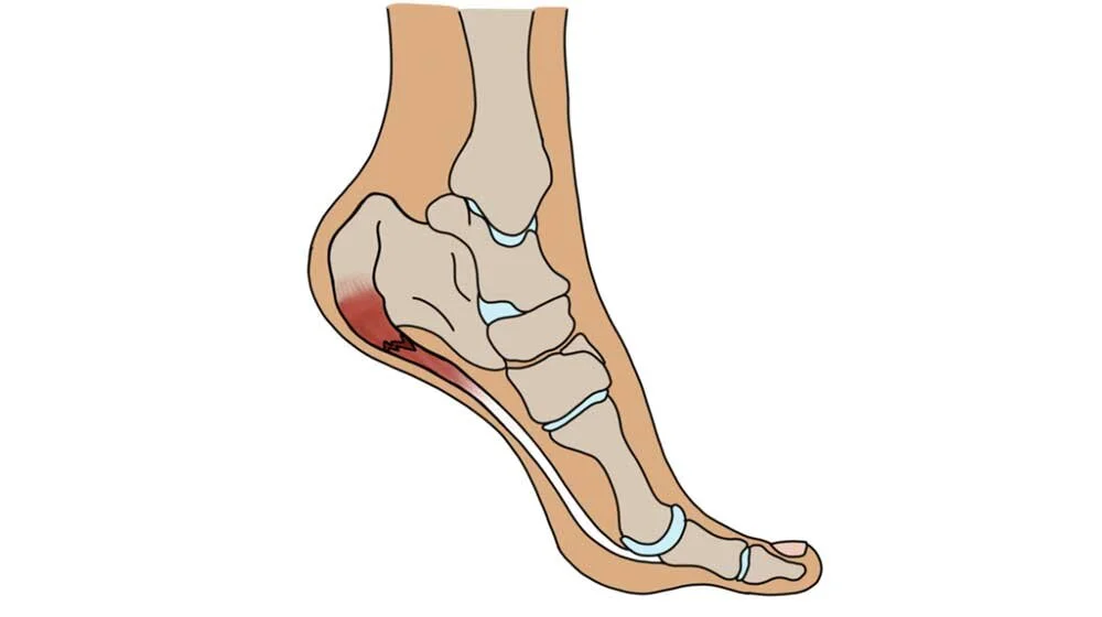 Cheap vans heel pain Shop