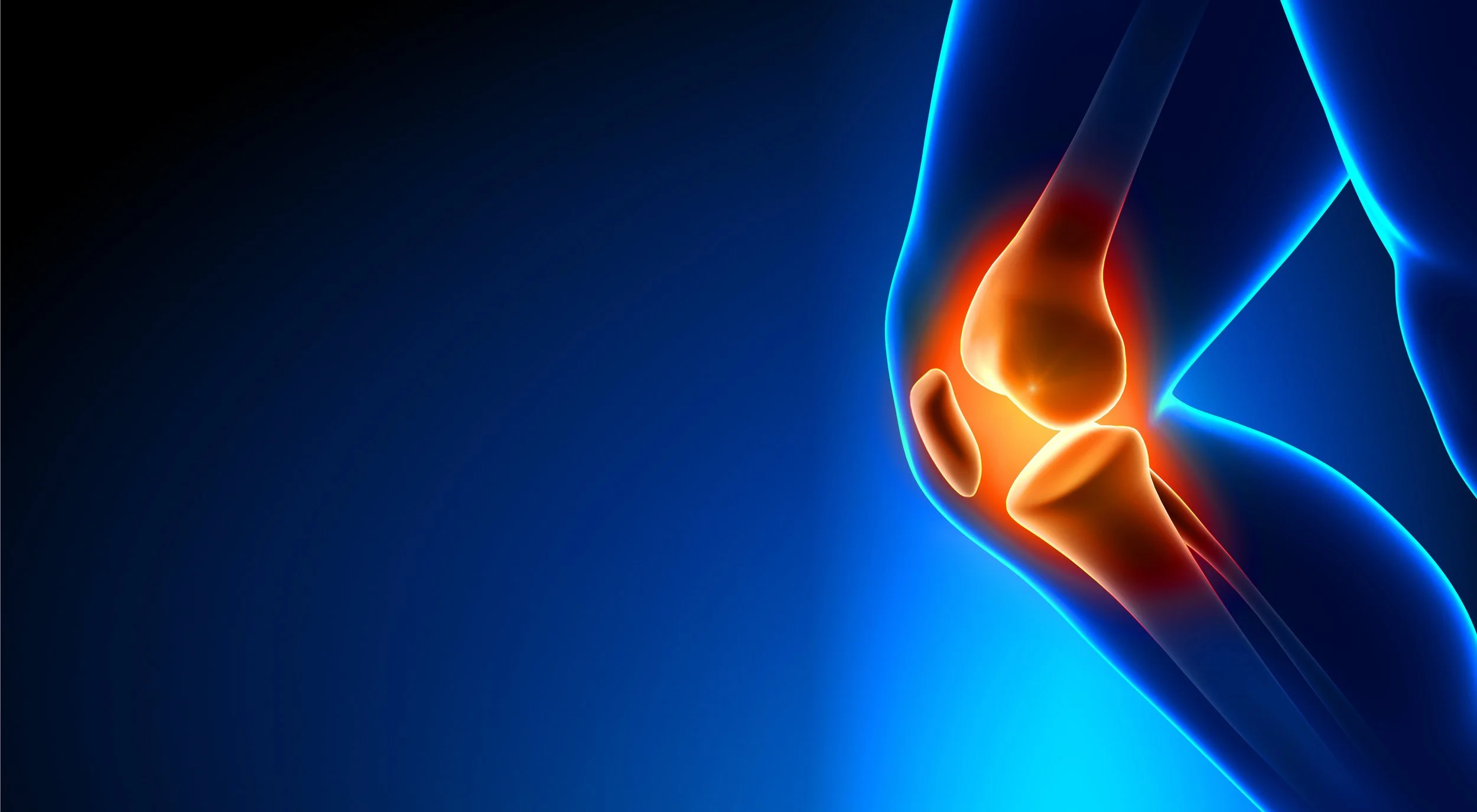 Knee Injuries Minimally invasive knee replacement | ACL reconstruction | Cartilage Transplant | Meniscal repair | Ligament Reconstruction | Patellofemoral Syndrome | MACI procedure SCHEDULE AN APPOINTMENT
