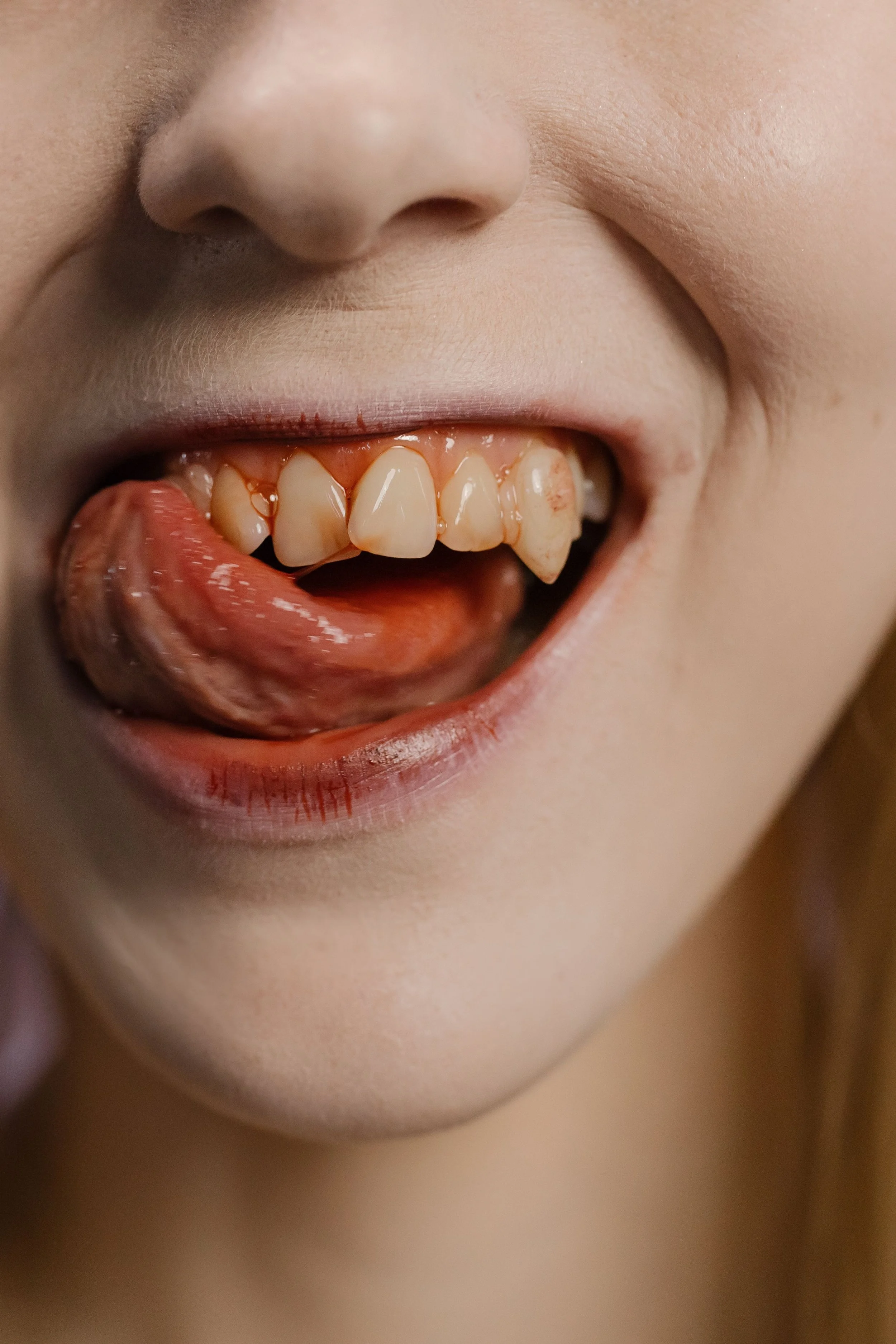 Why Are My Gums Bleeding When I Brush?