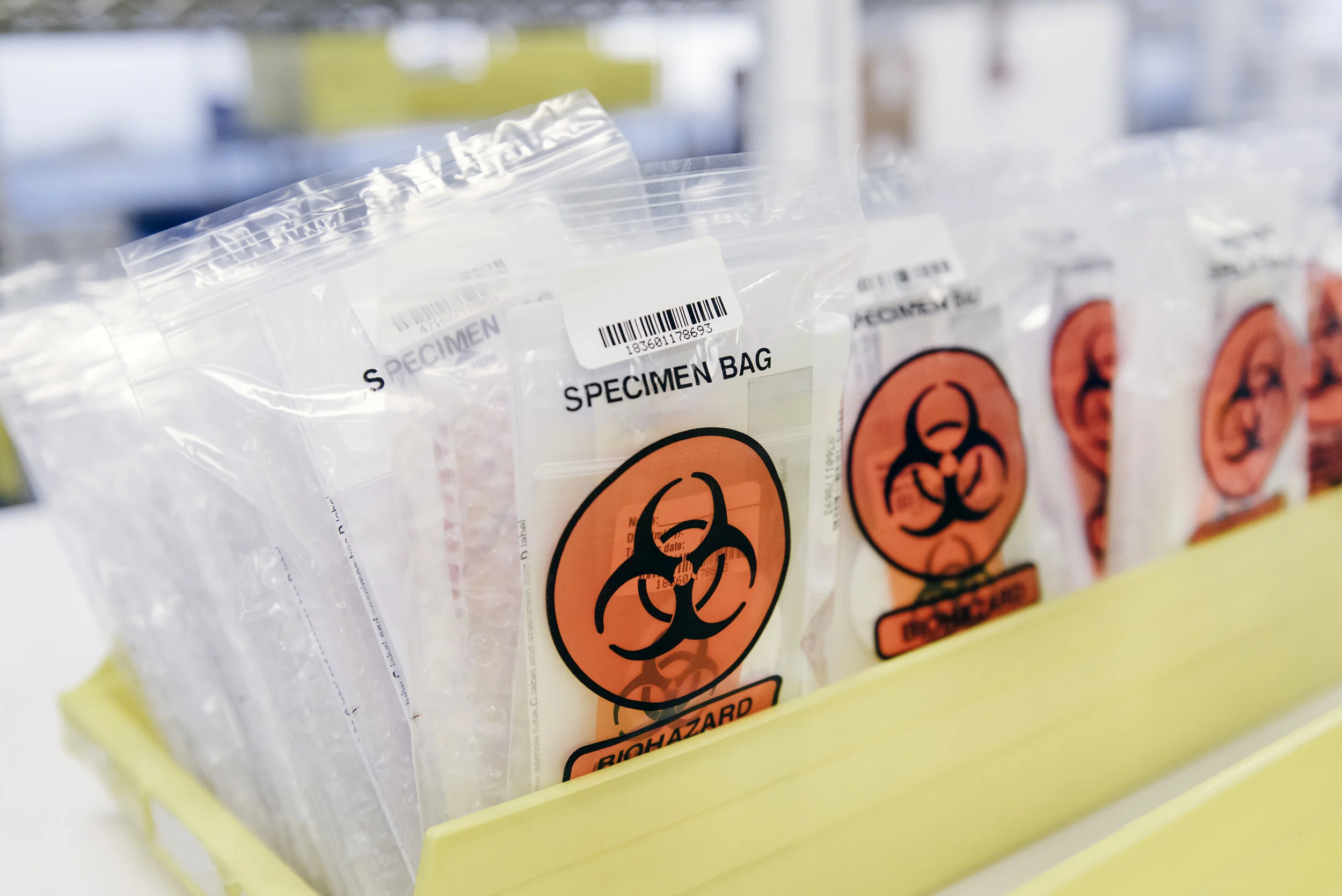  Assembly workers assemble Covid-19 testing kits at Evolve Manufacturing Technologies Inc., which has switched from making other medical equipment to making supplies for clients fighting the novel coronavirus, in Fremont, Calif, on Wednesday, April ,