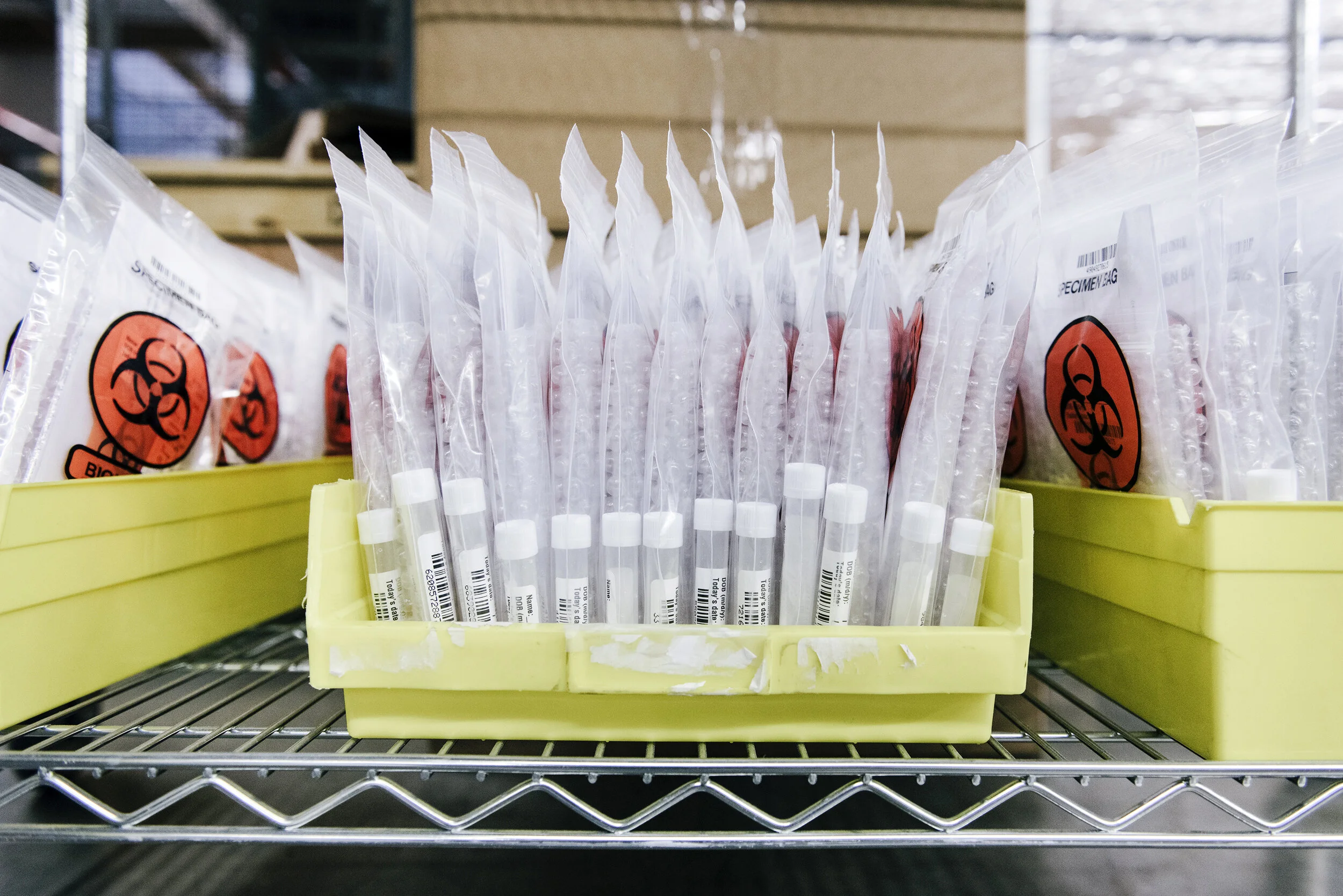  Assembly workers assemble Covid-19 testing kits at Evolve Manufacturing Technologies Inc., which has switched from making other medical equipment to making supplies for clients fighting the novel coronavirus, in Fremont, Calif, on Wednesday, April ,