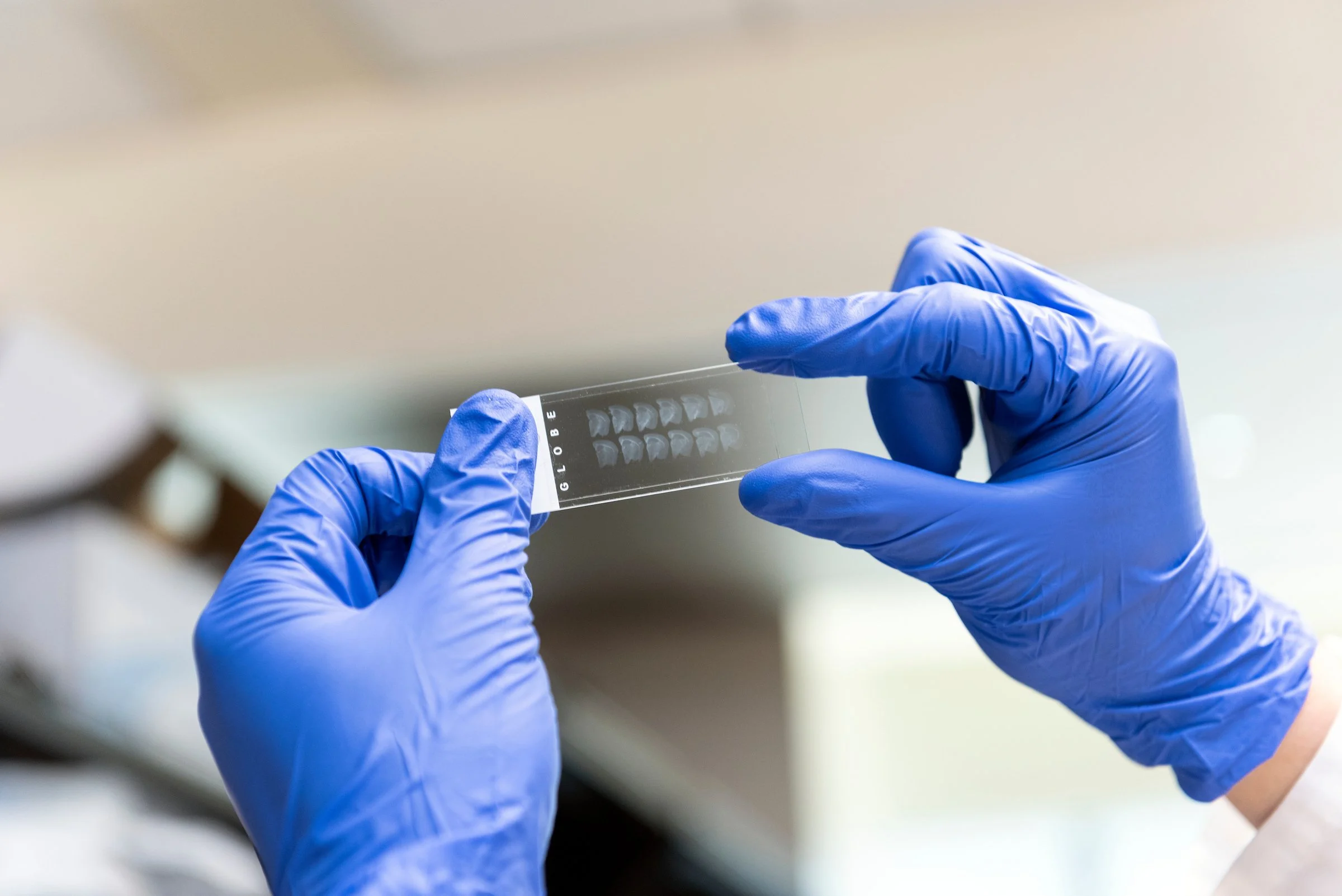  Work generated as a staff photographer for Gladstone Institutes, a non-profit bio medical research institute. 