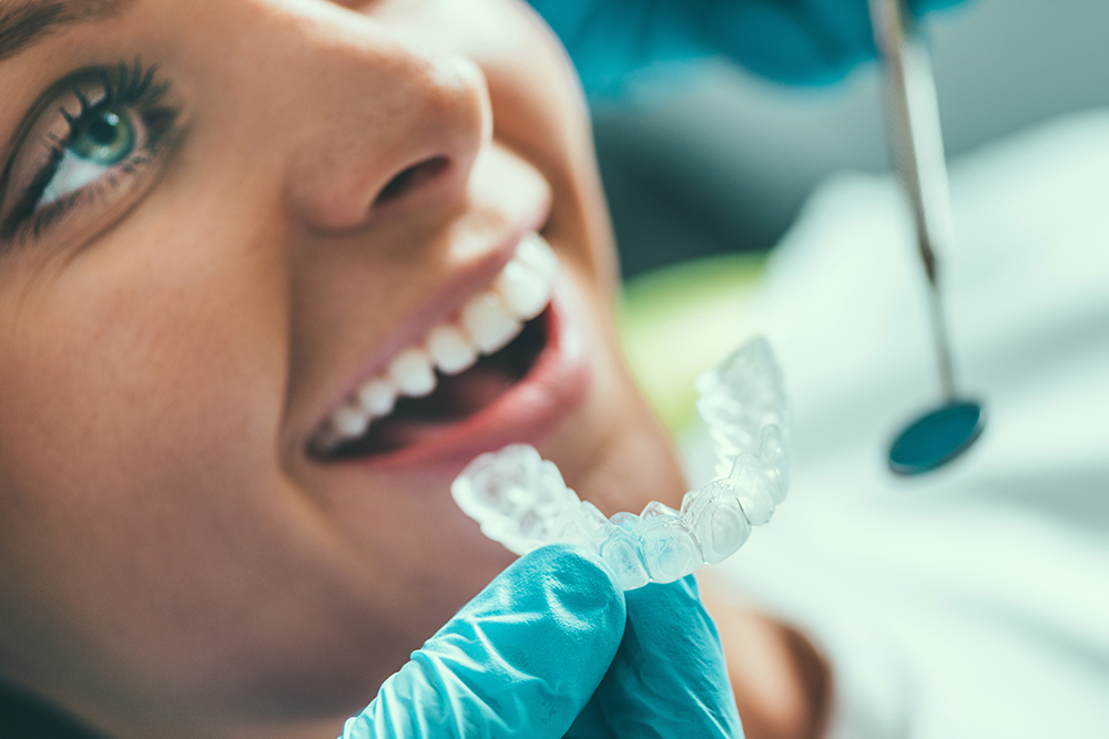 tooth-whitening-procedure-P7NFRZA.png