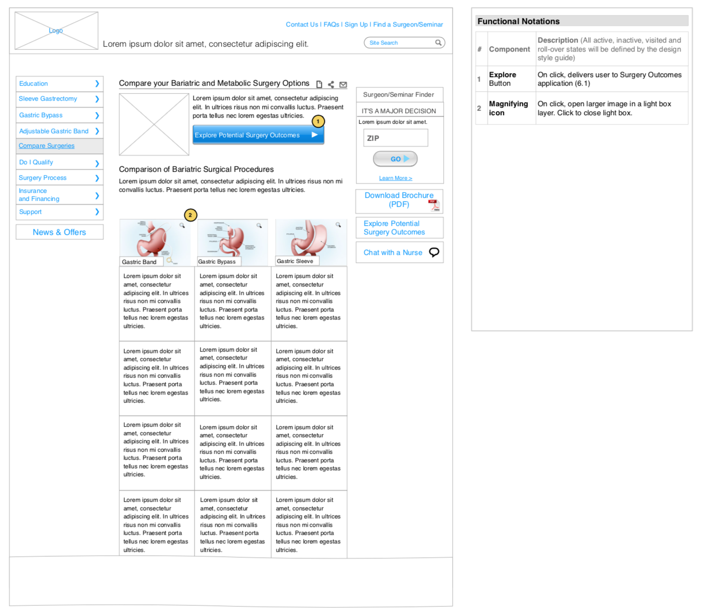 Comparing surgeries: wireframes and Realize.com (circa 2013)