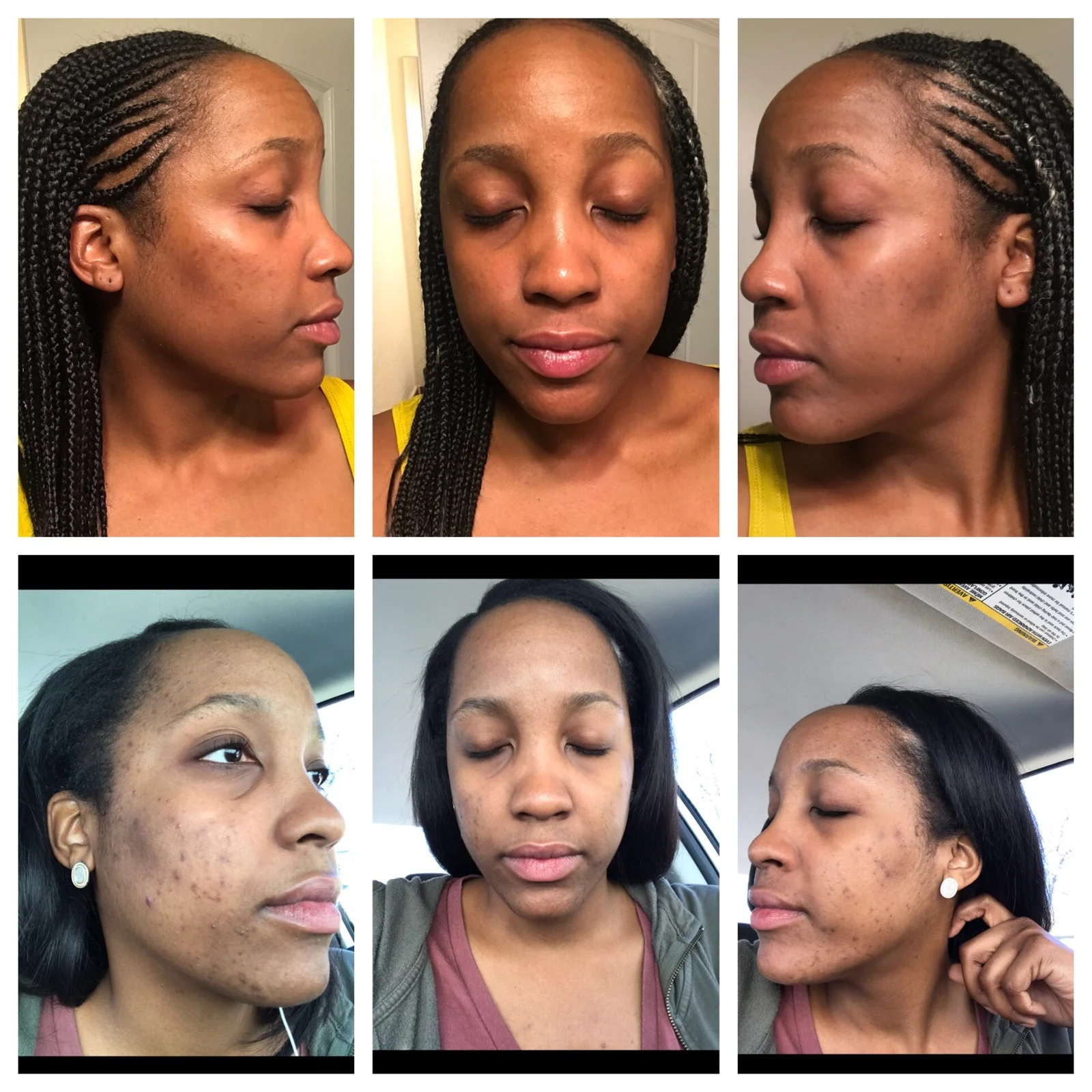 clear beauty acne clinic