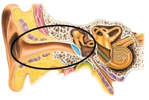 For conductive hearing losses, it’s recommended a patient sees a physician, most often one that specializes in diseases of the Ear Nose and Throat, called an Otolaryngologist or ENT.