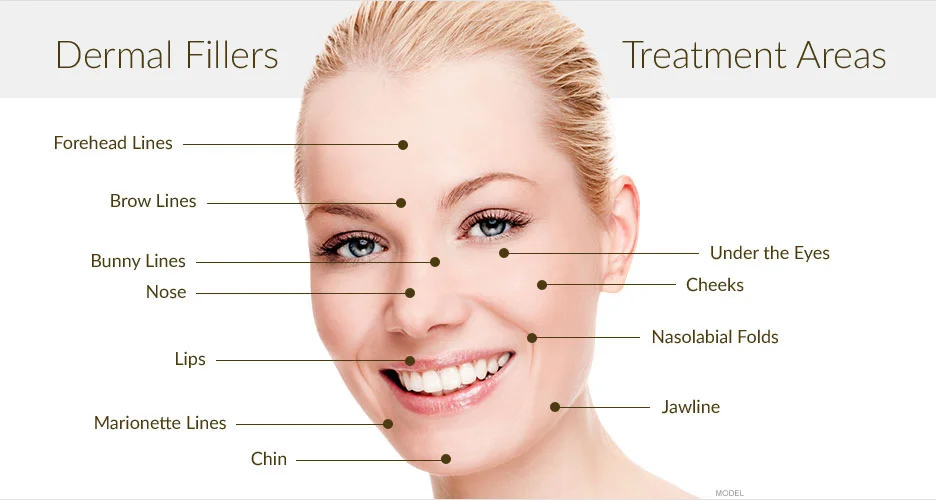 dermal-filler-treatment-areas-wellington-.jpg
