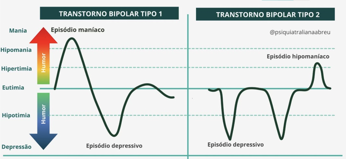 Subtipos do Transtorno Bipolar