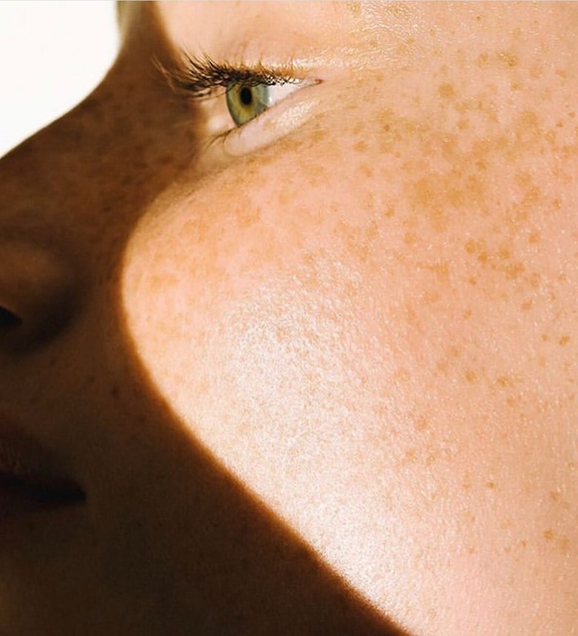 Skin Needling⚡️

Did you know Micro-needling achieves similar results to fractional laser! But - without the side effects or downtime 💁🏻&zwj;♀️ and it can even be used in delicate or hard-to-reach areas around the eyes, eyelids, lips, neck, nose an