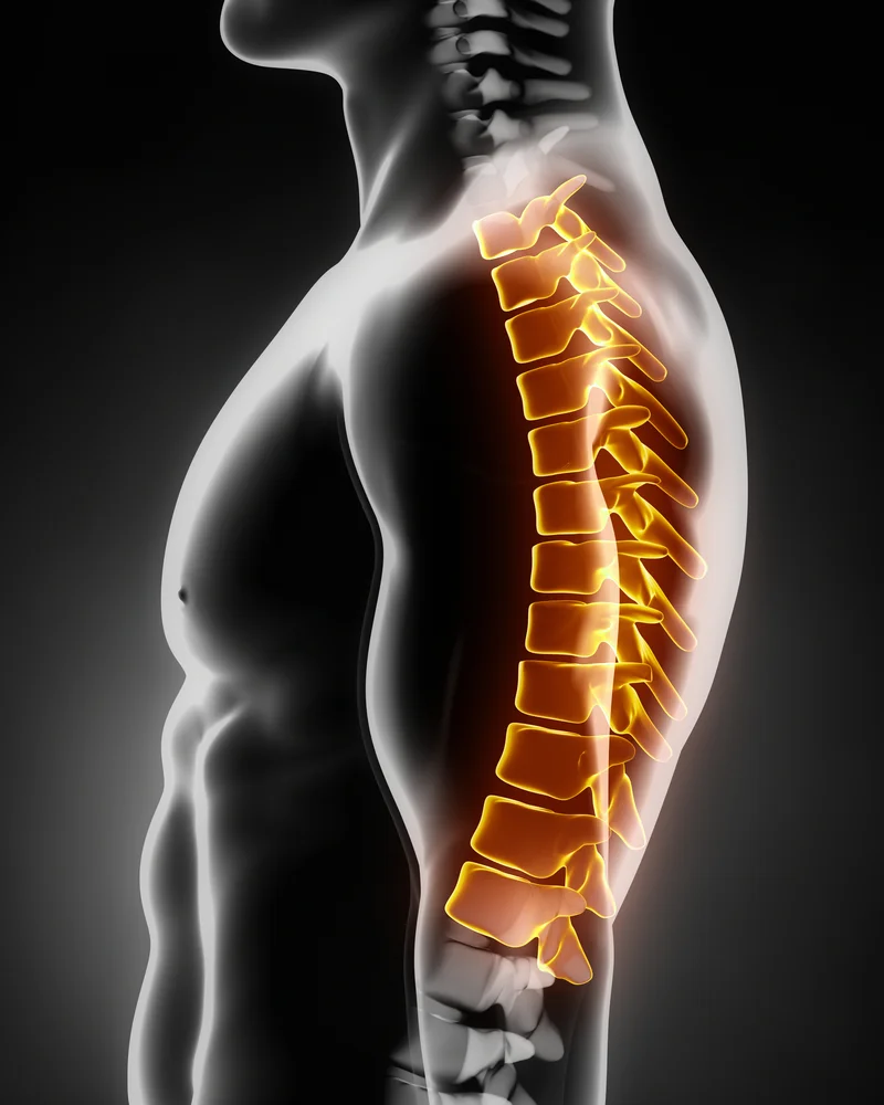 Back Pain Thoracic Spine (Middle) — Renwick Sports Physiotherapy &  Orthopaedic Centre