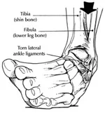 AnkleAnatomy.jpg