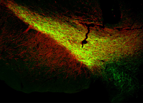 Immunohistochemistry.