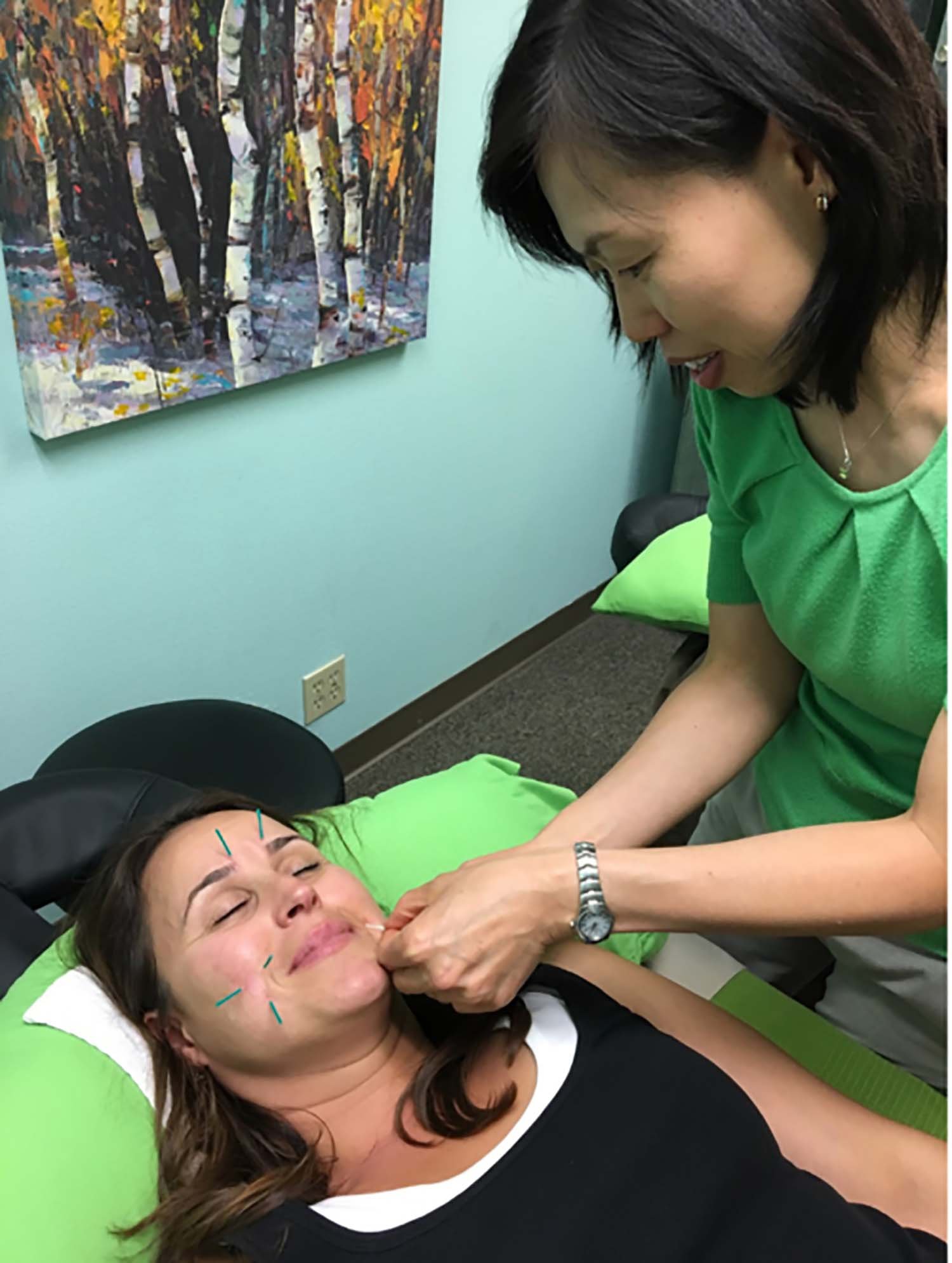 Dr. Iong Performing Facial Acupuncture on a Patient