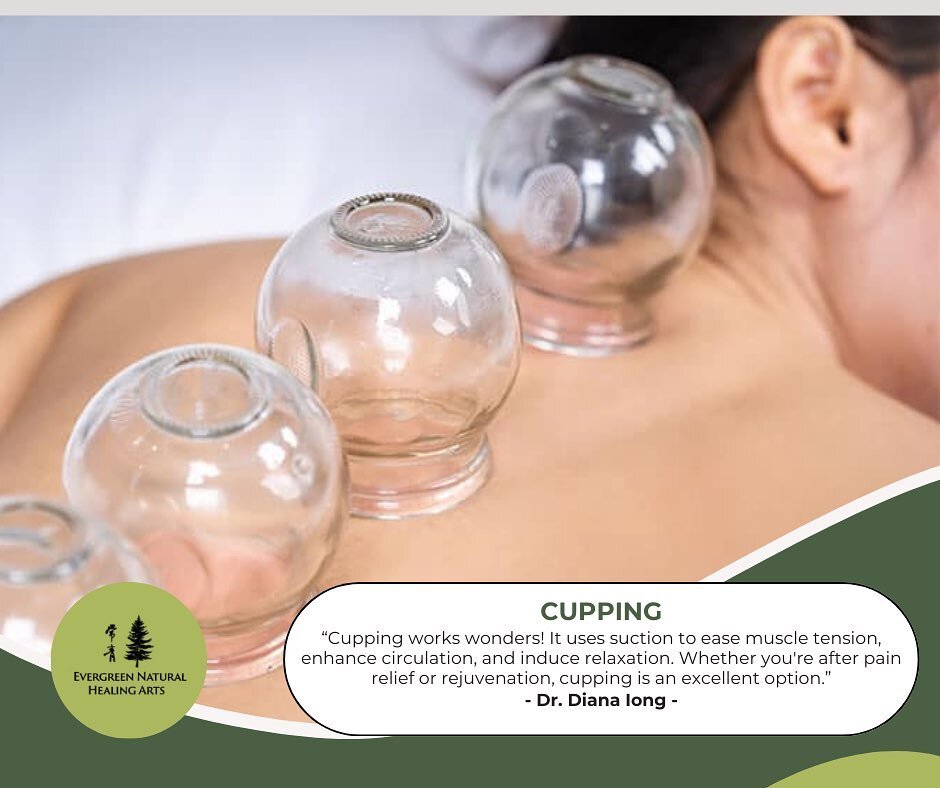 Ready to explore the ancient practice of cupping therapy? 🌟 

Say goodbye to tension, stress, and muscle tightness as you indulge in this rejuvenating treatment. Feel the gentle suction release tension and promote circulation, leaving you feeling re