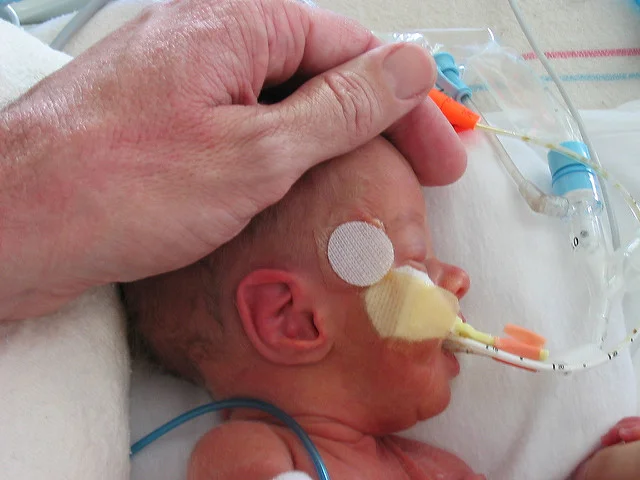 NICU Touch Head.jpg