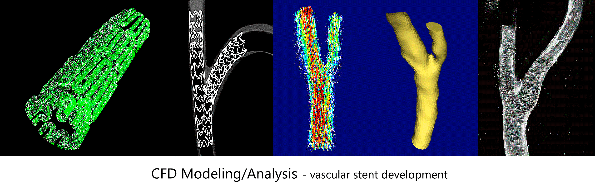 Computational-Fluid-Dynamics-for-Stenting-Banner-2-2500-x-800.gif
