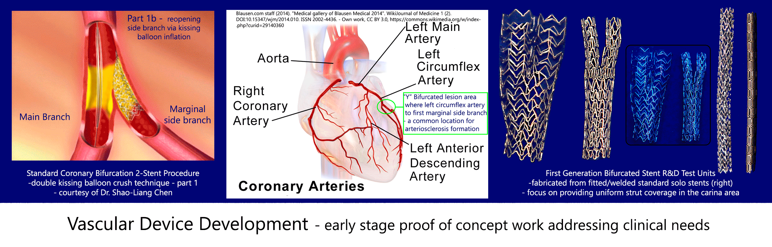 Vascular-Device-Development-Banner-Part-1b-2500-x-800.gif