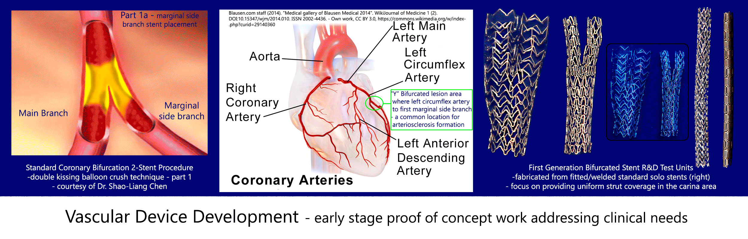 Vascular-Device-Development-Banner-Part-1a-2500-x-800.gif