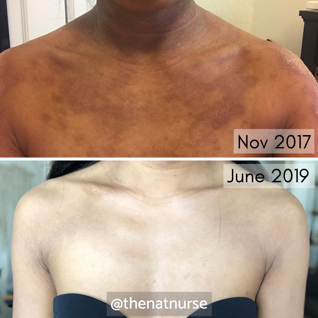 Copy of Copy of Copy of Copy of Progress face 1.png